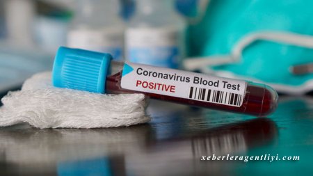 Azərbaycanda daha 12 nəfər koronavirusdan sağaldı - RƏSMİ