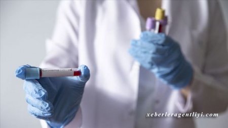 Azərbaycanda koronavirusa yoluxmuş daha 41 nəfər sağalıb, bir nəfər isə vəfat edib - RƏSMİ