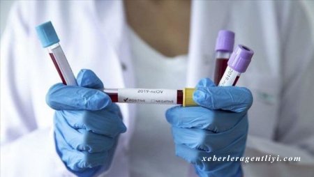 Azərbaycanda daha bir nəfər koronavirusdan öldü - 44 yeni yoluxma