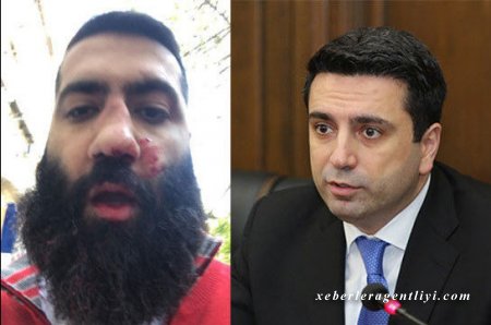 Ermənistan parlamentinin vitse-spikeri bloqerin burnunu dağıtdı