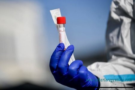 Koronavirus testlərinin səhv nəticə verməsinin səbəbi açıqlandı
