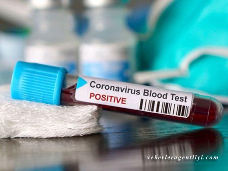 Azərbaycanda daha 230 nəfər koronavirusa yoluxdu - 103 pasiyent sağaldı, ikisi vəfat etdi