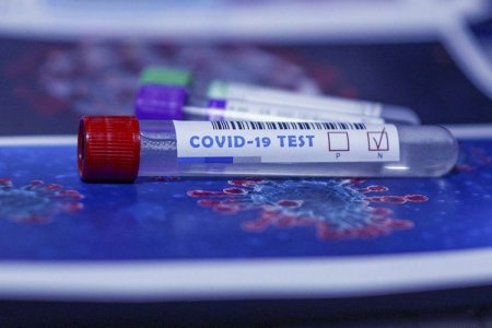 Azərbaycanda indiyədək 2627991 koronavirus testi aparılıb