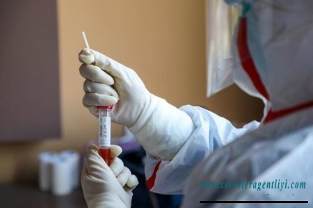 Azərbaycanda daha 62 nəfər koronavirusdan sağaldı - RƏSMİ