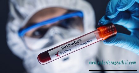 Azərbaycanda daha 325 nəfər koronavirusa yoluxub, 5 nəfər ölüb