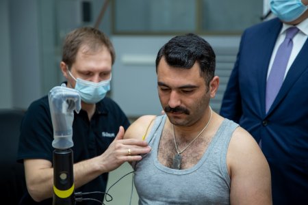 Yuxarı ətrafları amputasiya olunmuş qazilərimizin yüksək texnologiyalı protezlərlə təminatına başlanır