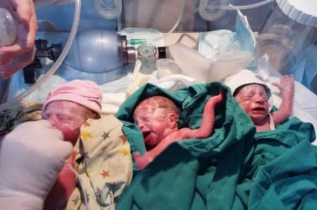 Bakıda koronavirusa yoluxan iki hamilə qadından biri üçəm, digəri dördəm dünyaya gətirdi - FOTO