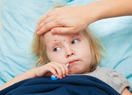 Qızılca niyə tüğyan edir: Diqqət məktəbə – AKTUAL