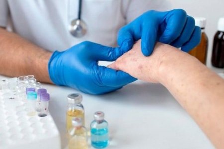 Cəlilabadda hazırda qızılca xəstəliyindən müalicə olunanların sayı AÇIQLANDI