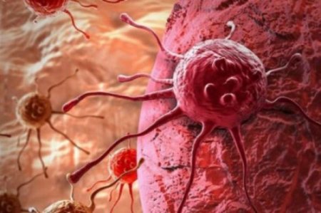 Xərçəngi məhv edən ƏN SADƏ YOL - 7 dəfə Nobel qazanan HƏKİMİN MƏSLƏHƏTİ